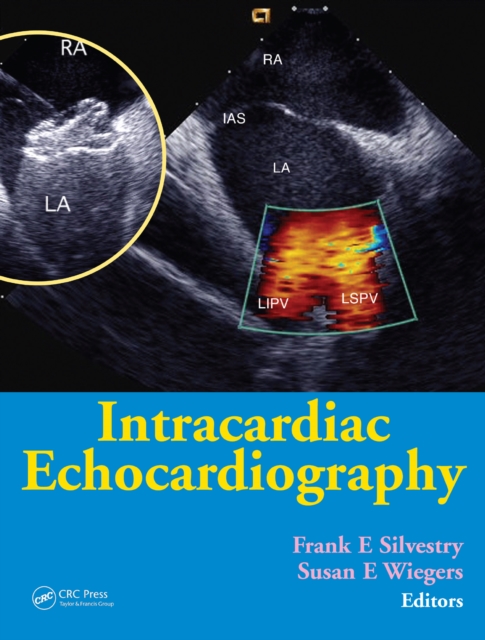 Intracardiac Echocardiography, EPUB eBook
