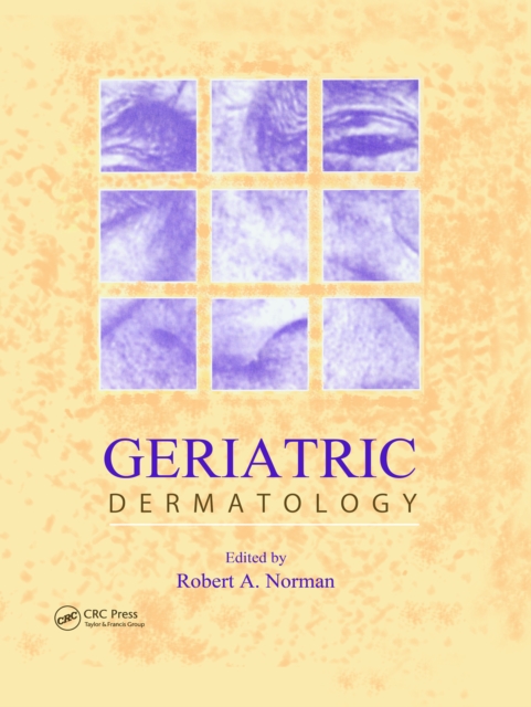 Geriatric Dermatology, EPUB eBook