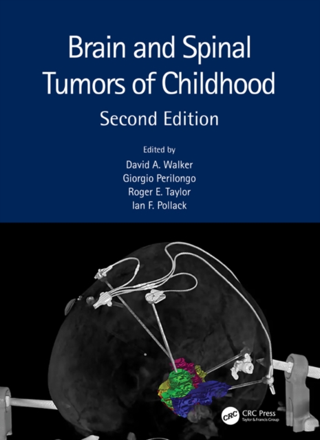 Brain and Spinal Tumors of Childhood, EPUB eBook