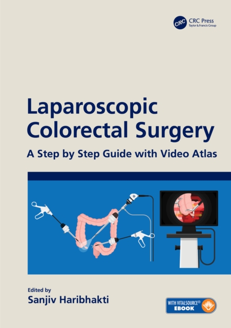 Laparoscopic Colorectal Surgery : A Step by Step Guide with Video Atlas, PDF eBook