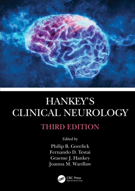 Hankey's Clinical Neurology, PDF eBook