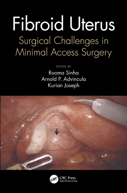 Fibroid Uterus : Surgical Challenges in Minimal Access Surgery, EPUB eBook
