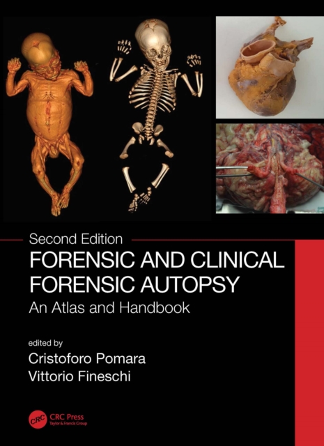 Forensic and Clinical Forensic Autopsy : An Atlas and Handbook, EPUB eBook