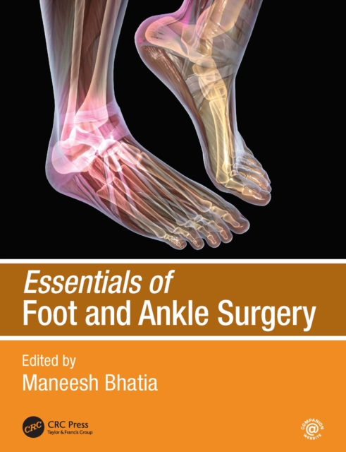Essentials of Foot and Ankle Surgery, EPUB eBook