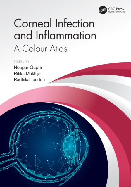 Corneal Infection and Inflammation : A Colour Atlas, PDF eBook