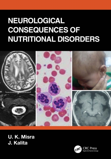 Neurological Consequences of Nutritional Disorders, PDF eBook