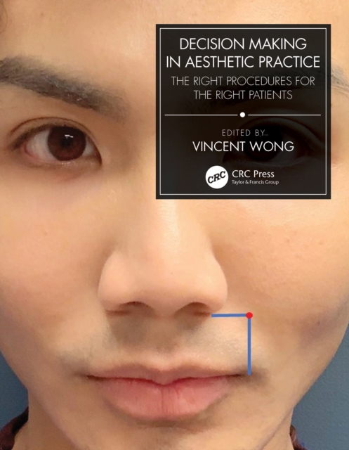 Decision Making in Aesthetic Practice : The Right Procedures for the Right Patients, PDF eBook