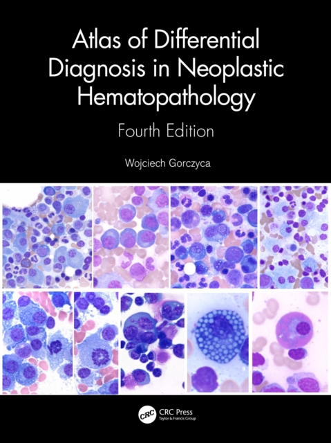 Atlas of Differential Diagnosis in Neoplastic Hematopathology, EPUB eBook