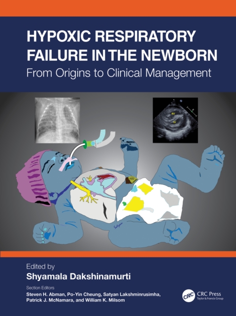 Hypoxic Respiratory Failure in the Newborn : From Origins to Clinical Management, PDF eBook
