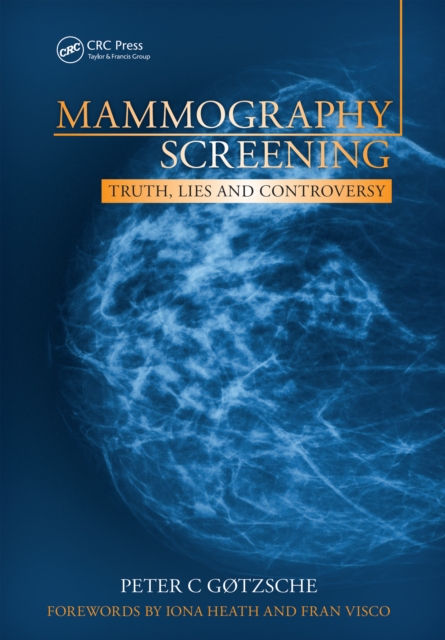 Mammography Screening : Truth, Lies and Controversy, EPUB eBook