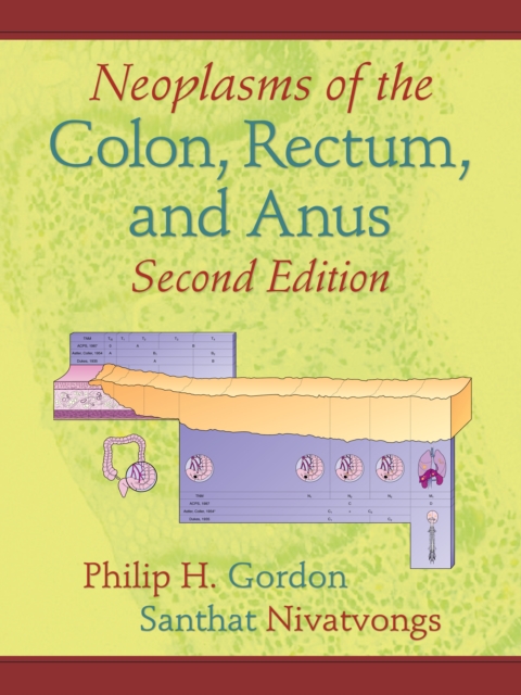 Neoplasms of the Colon, Rectum, and Anus, EPUB eBook
