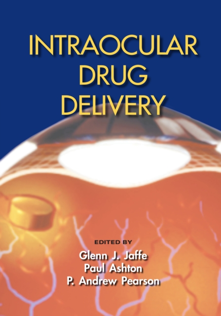 Intraocular Drug Delivery, EPUB eBook