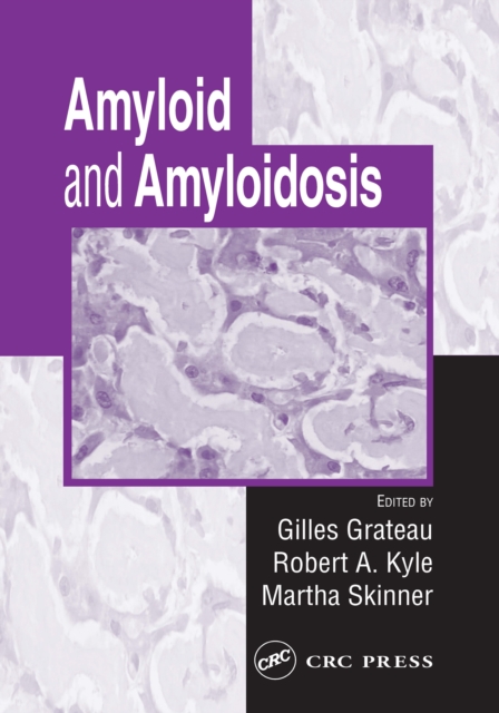 Amyloid and Amyloidosis, EPUB eBook