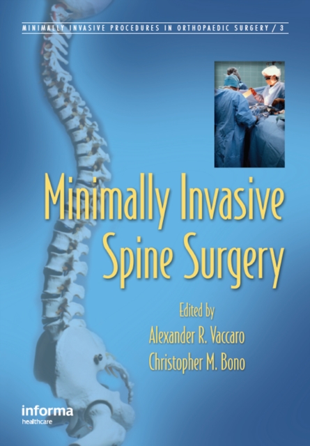 Minimally Invasive Spine Surgery, EPUB eBook