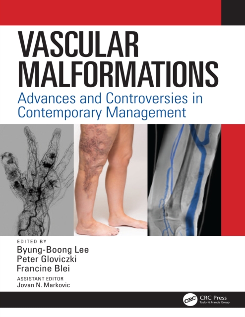 Vascular Malformations : Advances and Controversies in Contemporary Management, PDF eBook