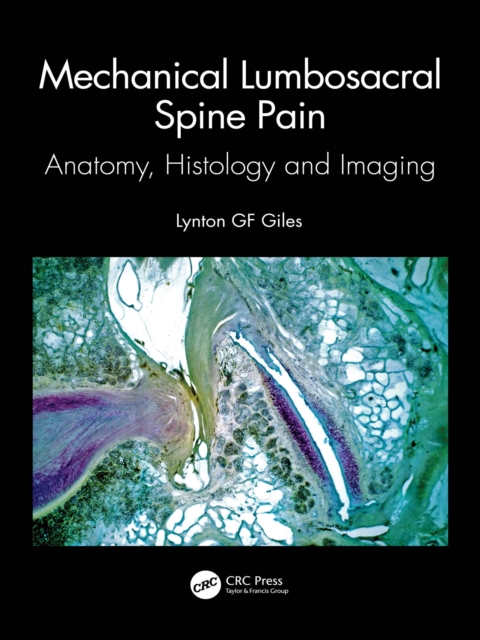 Mechanical Lumbosacral Spine Pain : Anatomy, Histology and Imaging, EPUB eBook