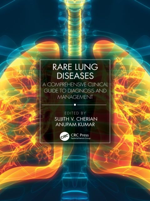 Rare Lung Diseases : A Comprehensive Clinical Guide to Diagnosis and Management, PDF eBook