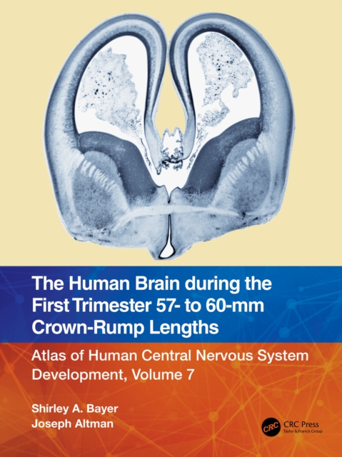 The Human Brain during the First Trimester 57- to 60-mm Crown-Rump Lengths : Atlas of Human Central Nervous System Development, Volume 7, PDF eBook