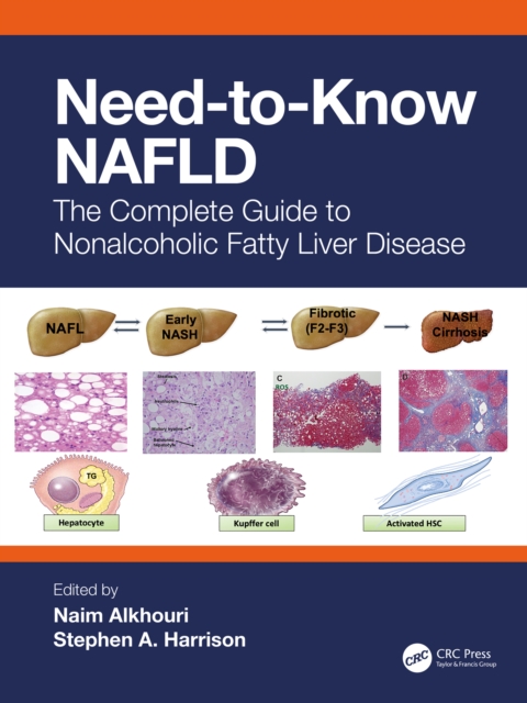 Need-to-Know NAFLD : The Complete Guide to Nonalcoholic Fatty Liver Disease, PDF eBook