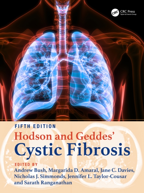 Hodson and Geddes' Cystic Fibrosis, EPUB eBook