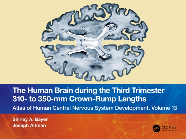 The Human Brain during the Third Trimester 310- to 350-mm Crown-Rump Lengths : Atlas of Central Nervous System Development, Volume 13, EPUB eBook