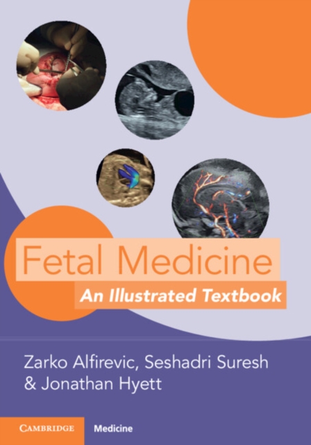 Fetal Medicine : An Illustrated Textbook, Paperback / softback Book