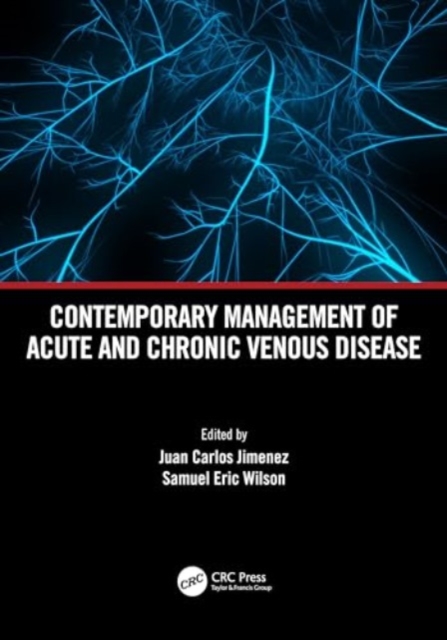 Contemporary Management of Acute and Chronic Venous Disease, Paperback / softback Book