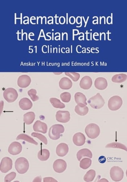 Haematology and the Asian Patient : 51 Clinical Cases, Paperback / softback Book