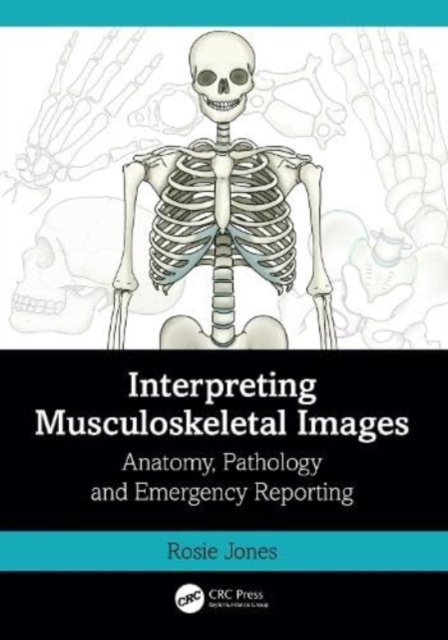 Interpreting Musculoskeletal Images : Anatomy, Pathology and Emergency Reporting, Paperback / softback Book