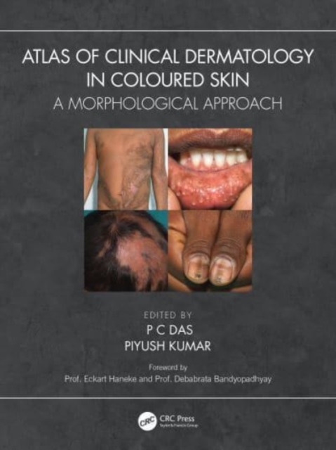 Atlas of Clinical Dermatology in Coloured Skin : A Morphological Approach, Paperback / softback Book