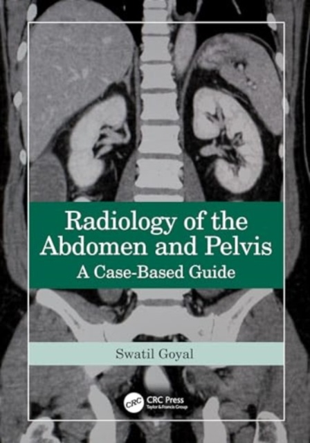 Radiology of the Abdomen and Pelvis : A Case-Based Guide, Hardback Book