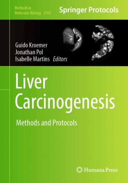 Liver Carcinogenesis : Methods and Protocols, EPUB eBook