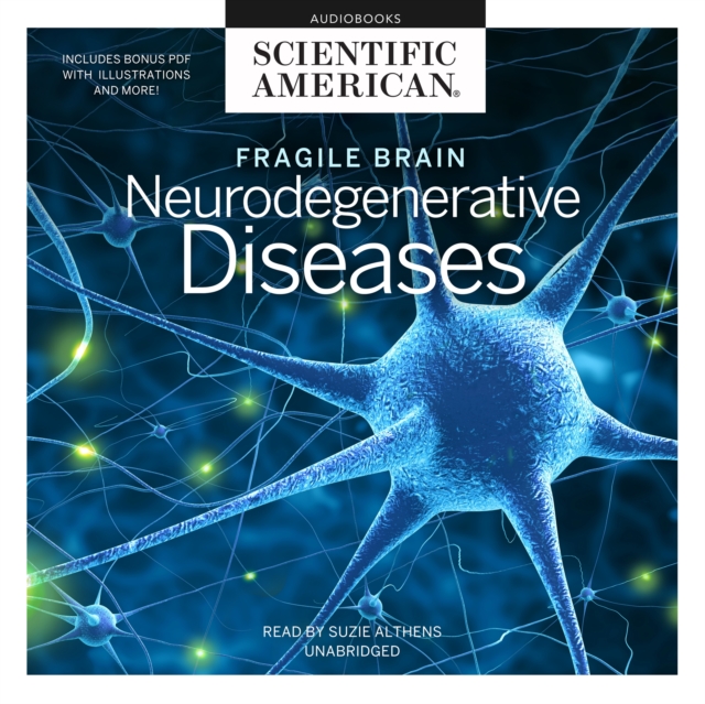 Fragile Brain, eAudiobook MP3 eaudioBook
