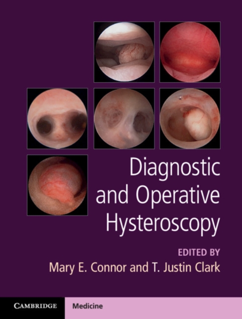 Diagnostic and Operative Hysteroscopy, Hardback Book