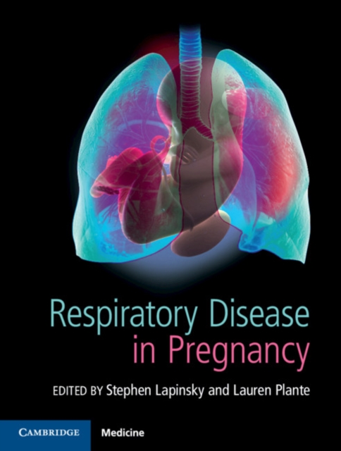 Respiratory Disease in Pregnancy, Hardback Book