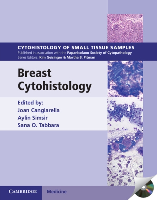 Breast Cytohistology, PDF eBook