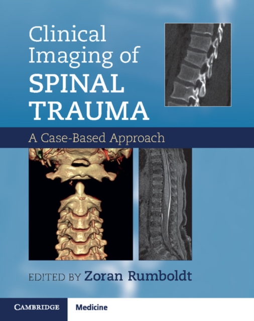 Clinical Imaging of Spinal Trauma : A Case-Based Approach, Paperback / softback Book