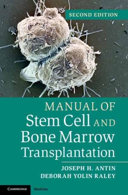 Manual of Stem Cell and Bone Marrow Transplantation, EPUB eBook