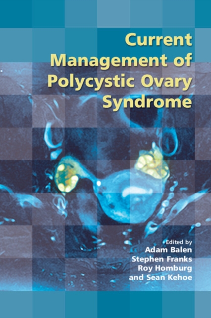 Current Management of Polycystic Ovary Syndrome, PDF eBook