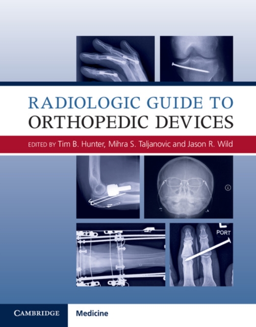 Radiologic Guide to Orthopedic Devices, PDF eBook