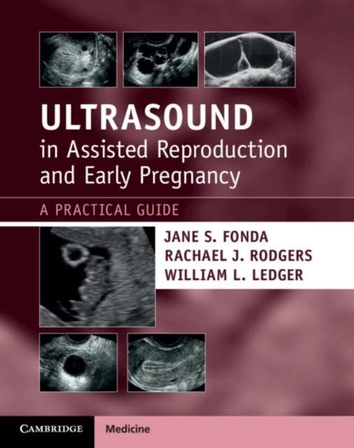 Ultrasound in Assisted Reproduction and Early Pregnancy : A Practical Guide, Paperback / softback Book