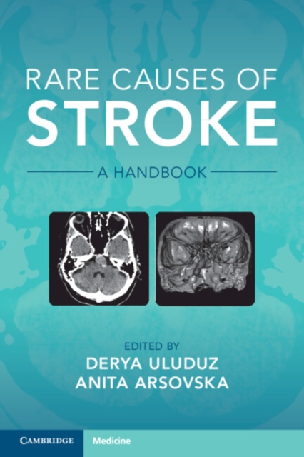 Rare Causes of Stroke : A Handbook, Paperback / softback Book