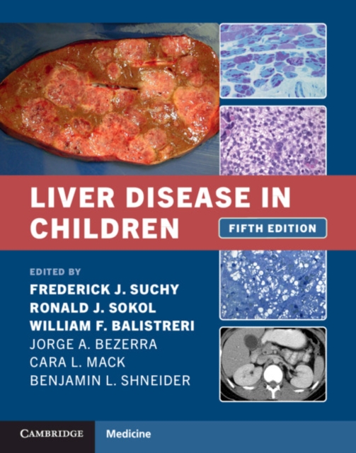 Liver Disease in Children, PDF eBook