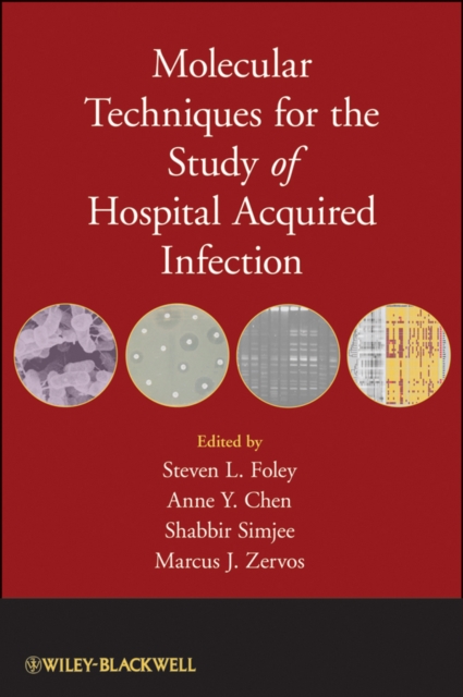 Molecular Techniques for the Study of Hospital Acquired Infection, PDF eBook