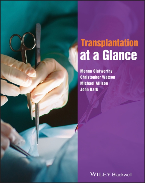 Transplantation at a Glance, PDF eBook