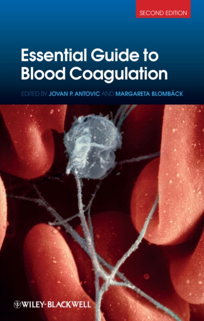 Essential Guide to Blood Coagulation, EPUB eBook