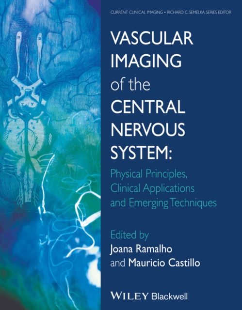 Vascular Imaging of the Central Nervous System : Physical Principles, Clinical Applications, and Emerging Techniques, EPUB eBook