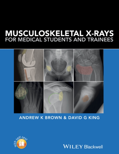 Musculoskeletal X-Rays for Medical Students and Trainees, PDF eBook