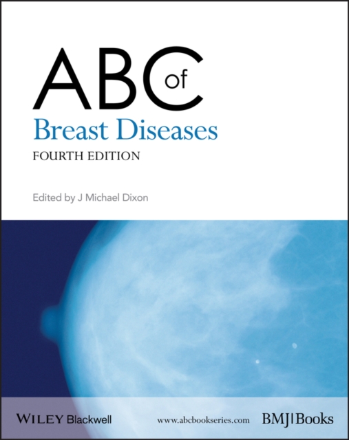ABC of Breast Diseases, EPUB eBook
