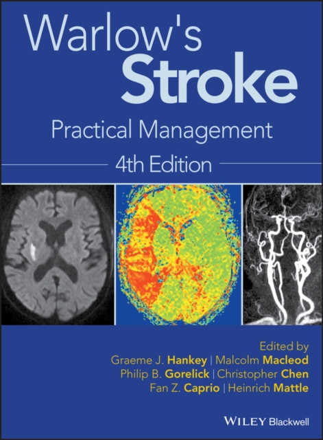 Warlow's Stroke : Practical Management, PDF eBook